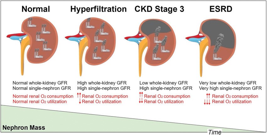 ハイパーフィルトレーション