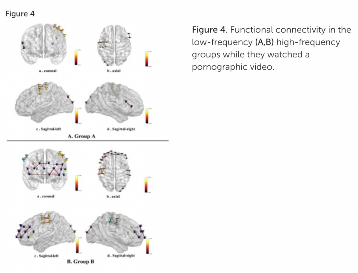 ポルノ視聴について知っておきたいこと 〜脳に与える影響と依存のメカニズム〜 | 産婦人科医・重見大介の本音ニュースレター