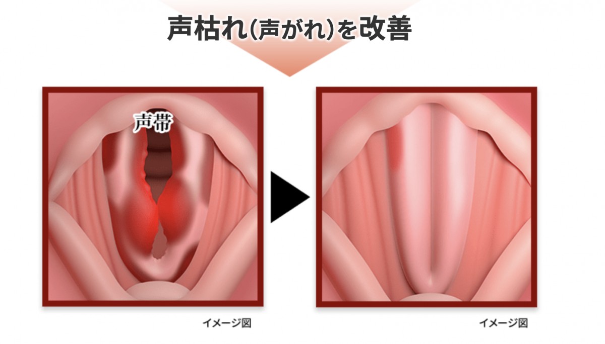 小林製薬の公式サイトより