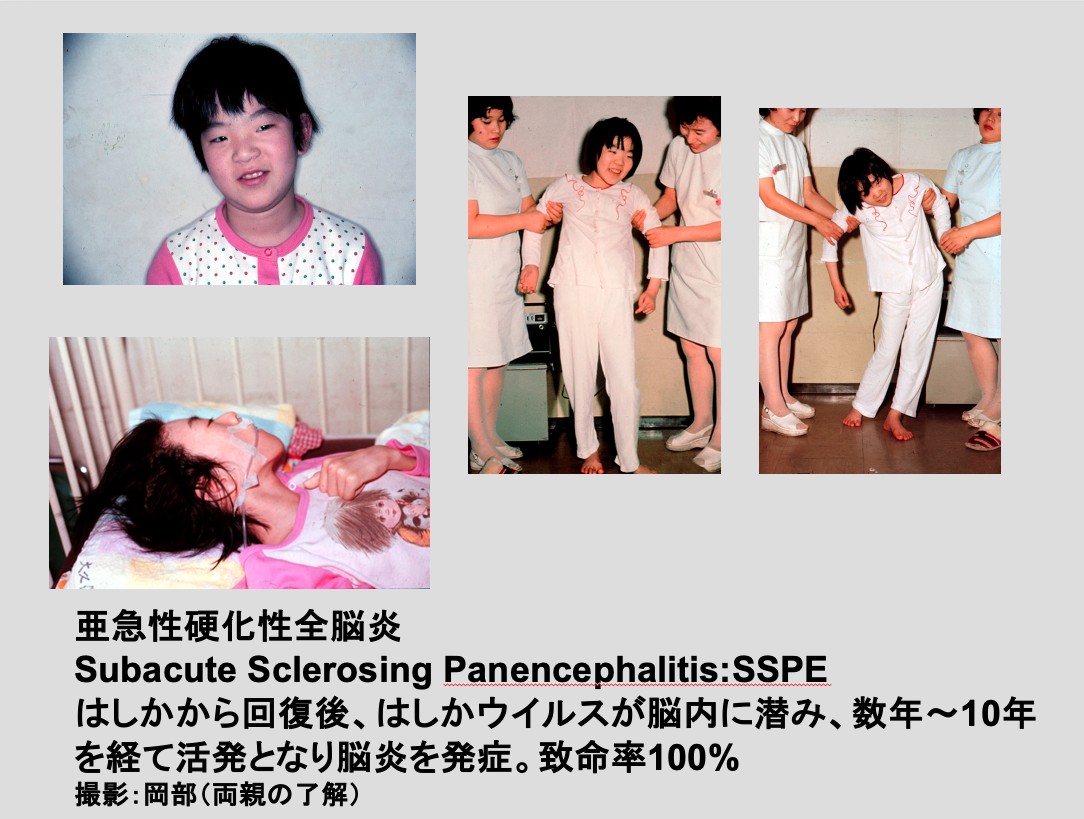岡部信彦さん提供