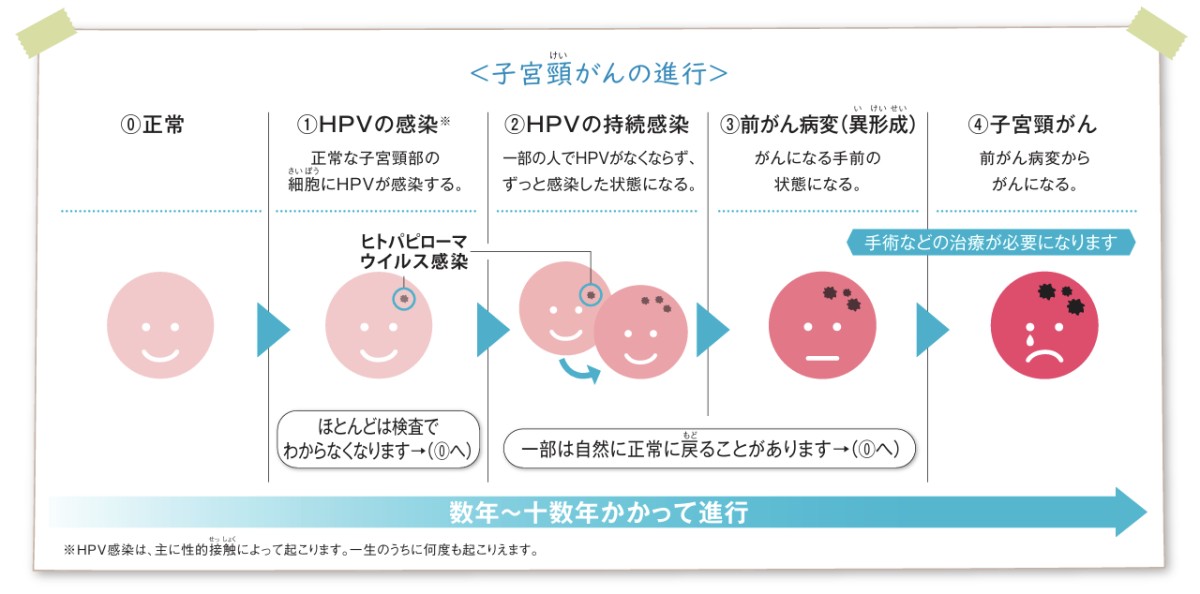 厚生労働省HPVワクチンリーフレットより