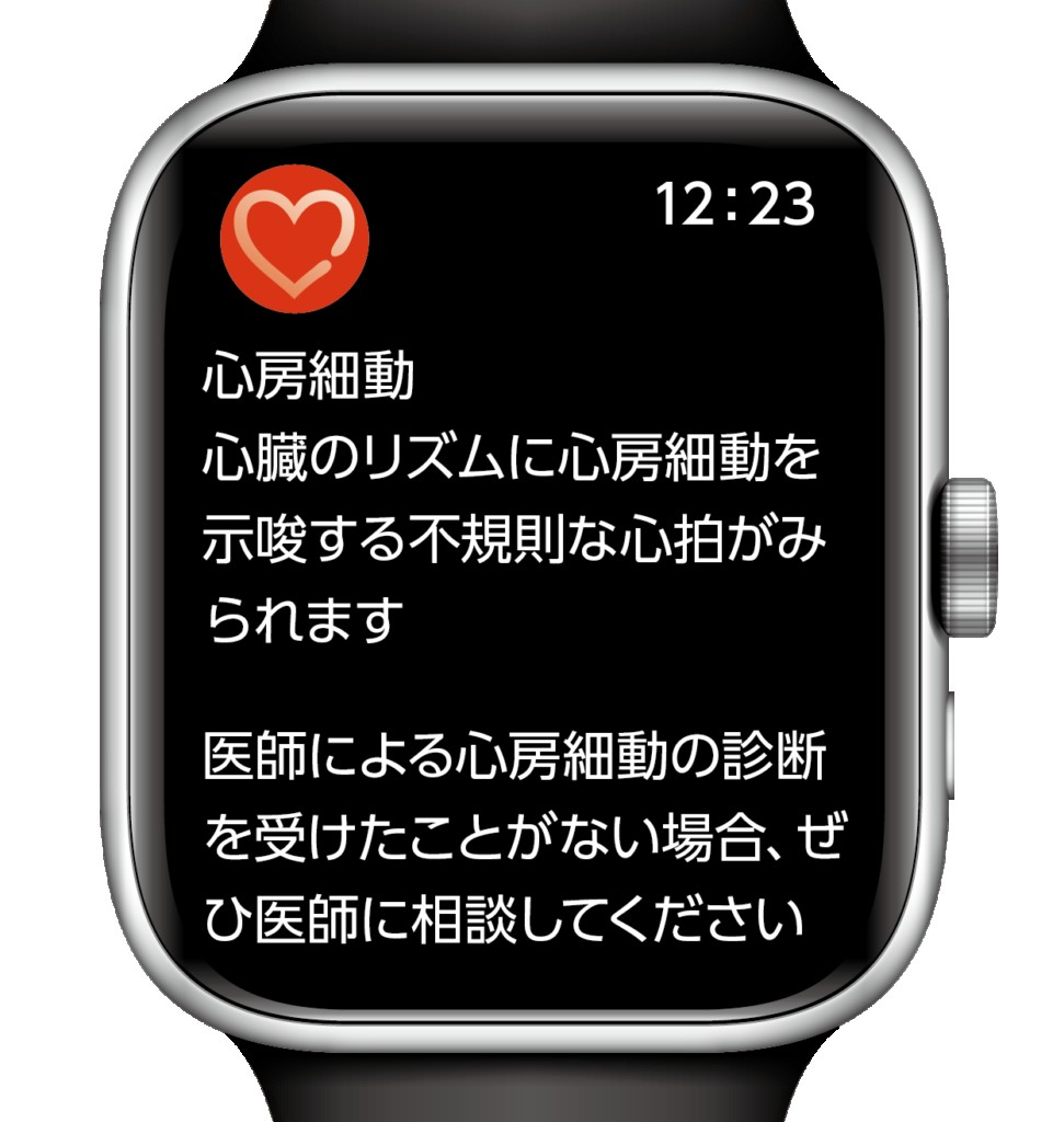 Apple watchの警告画面