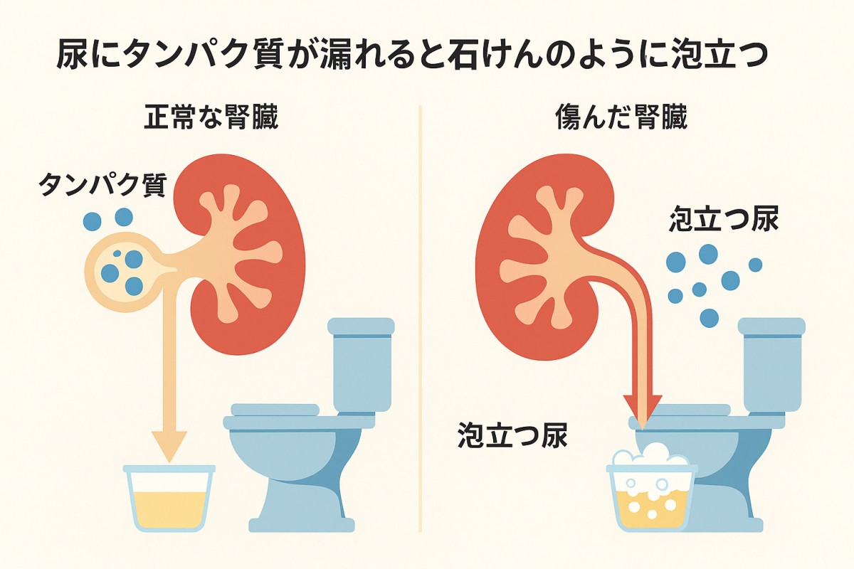 お シッコ 泡立つ