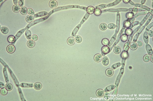 出典：Doctor Fungus